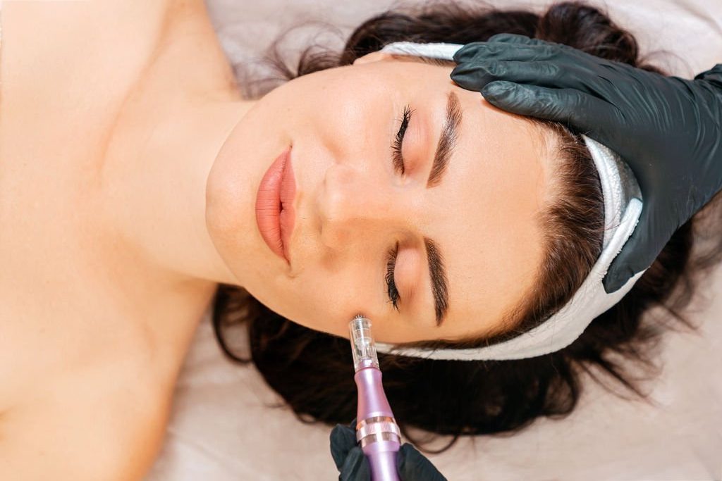 Microneedling